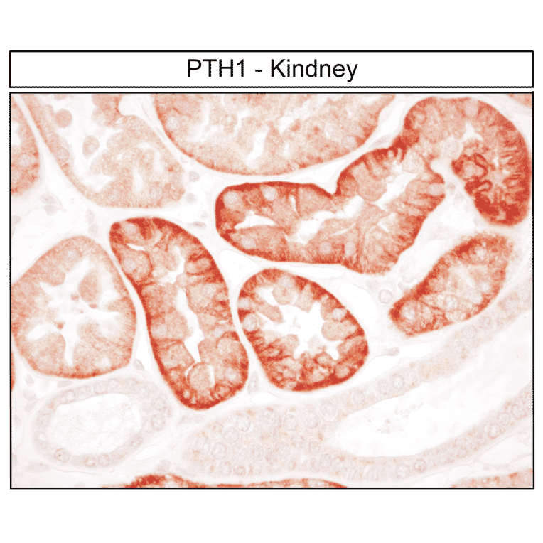 Immunohistochemistry - Anti-PTH1R Antibody (A334534) - Antibodies.com