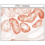 Immunohistochemistry - Anti-PTH1R Antibody (A334534) - Antibodies.com