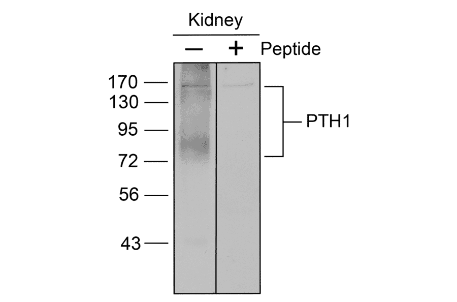 Western blot - Anti-PTH1R Antibody (A334534) - Antibodies.com