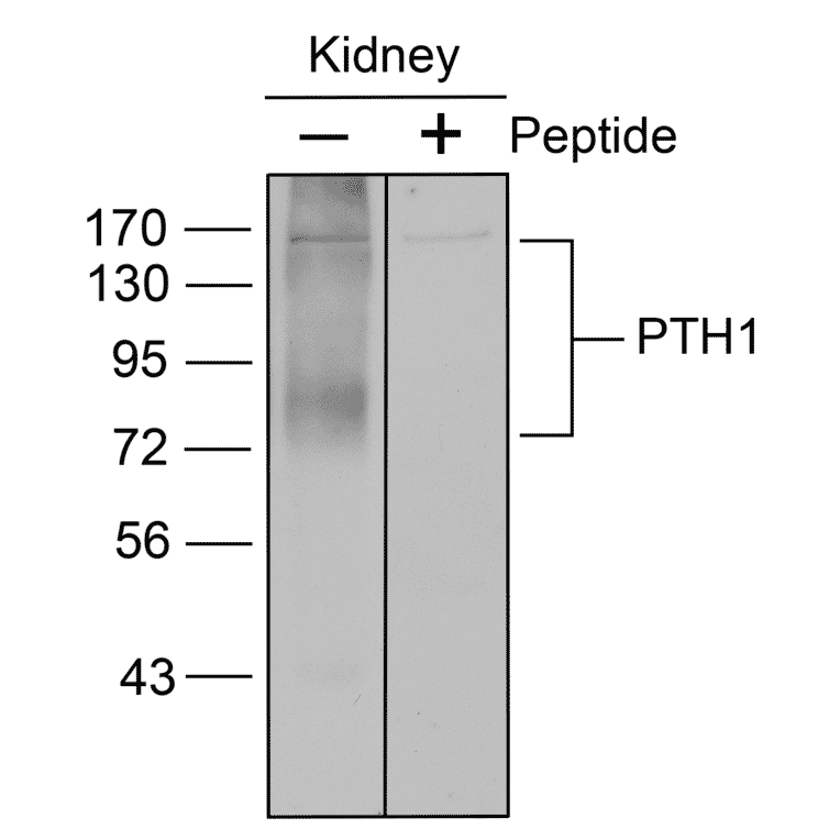 Western blot - Anti-PTH1R Antibody (A334534) - Antibodies.com