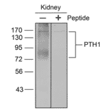 Western blot - Anti-PTH1R Antibody (A334534) - Antibodies.com