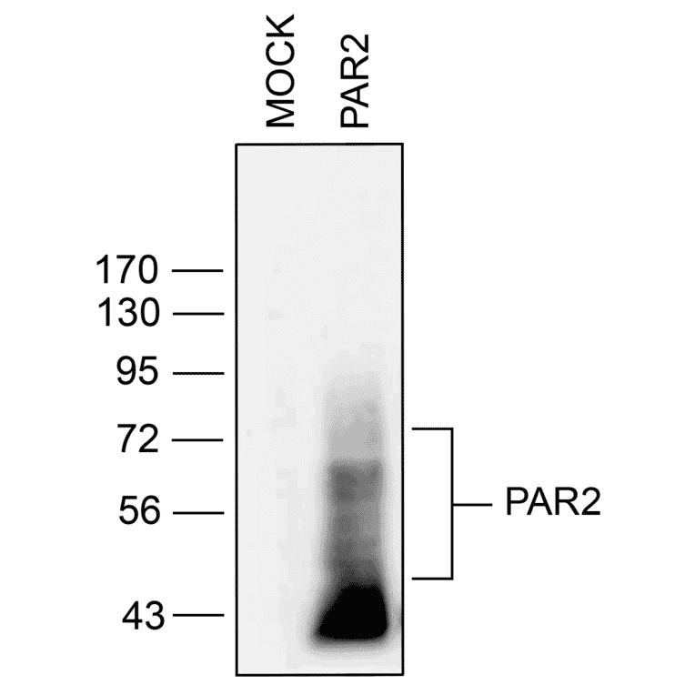 Western blot - Anti-PAR2 Antibody (A334538) - Antibodies.com