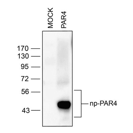Western blot - Anti-F2RL3 Antibody (A334539) - Antibodies.com