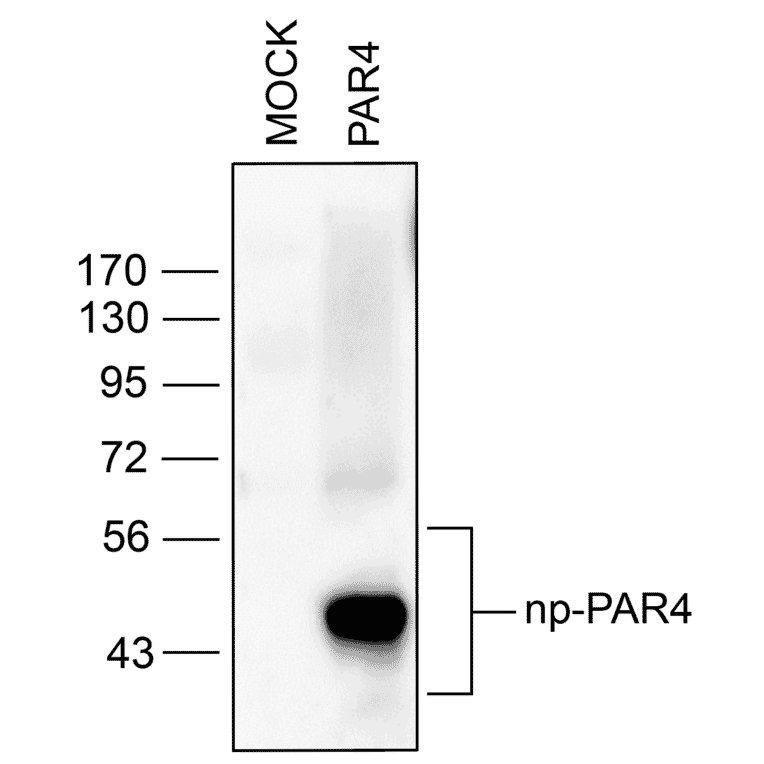 Western blot - Anti-F2RL3 Antibody (A334539) - Antibodies.com