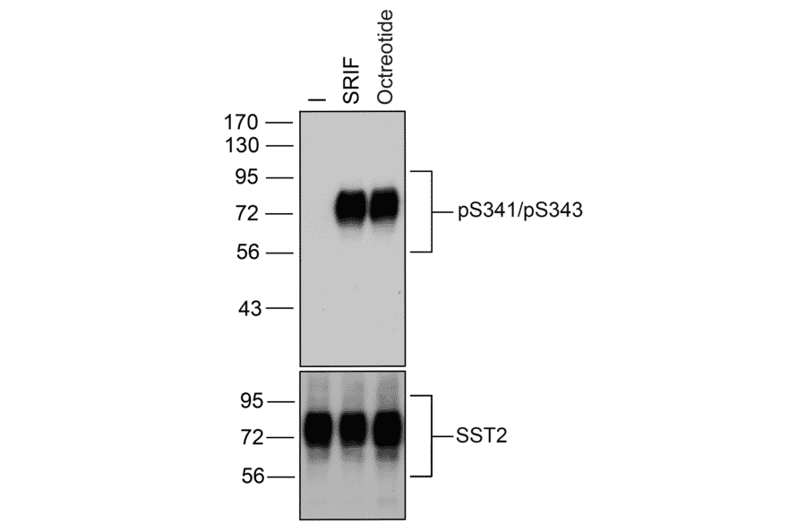 Western blot - Anti-SSTR2 (phospho Ser341 + Ser343) Antibody (A334540) - Antibodies.com