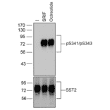 Western blot - Anti-SSTR2 (phospho Ser341 + Ser343) Antibody (A334540) - Antibodies.com