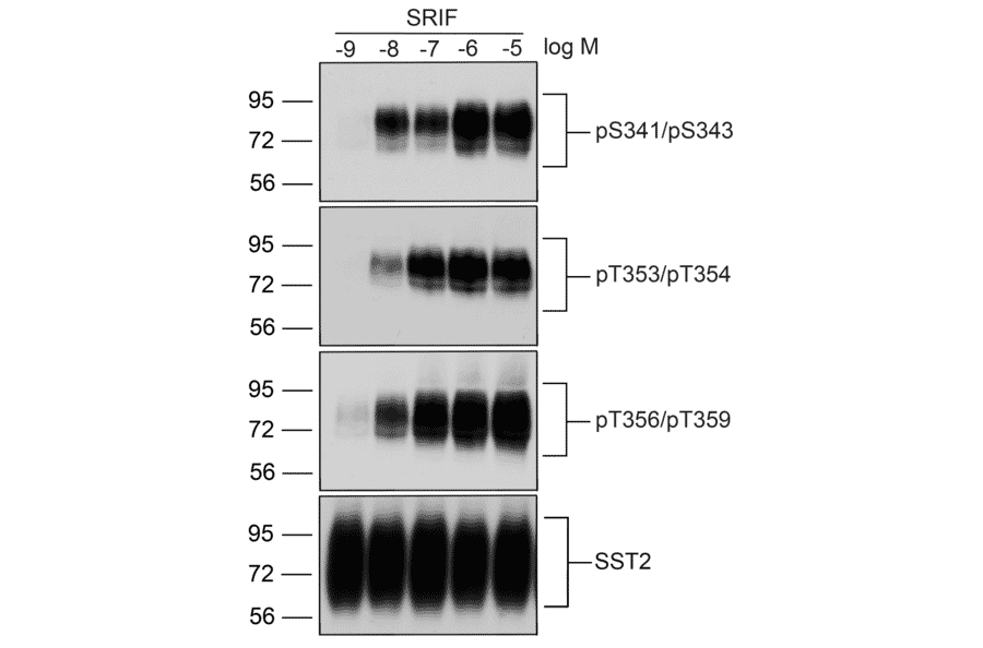 Western blot - Anti-SSTR2 (phospho Ser341 + Ser343) Antibody (A334540) - Antibodies.com