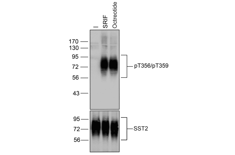 Western blot - Anti-SSTR2 (phospho Thr356 + Thr359) Antibody (A334541) - Antibodies.com