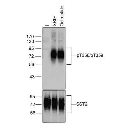 Western blot - Anti-SSTR2 (phospho Thr356 + Thr359) Antibody (A334541) - Antibodies.com