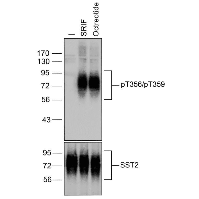 Western blot - Anti-SSTR2 (phospho Thr356 + Thr359) Antibody (A334541) - Antibodies.com