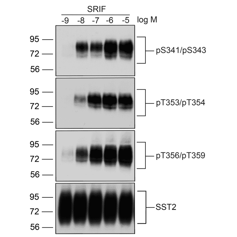 Western blot - Anti-SSTR2 (phospho Thr356 + Thr359) Antibody (A334541) - Antibodies.com