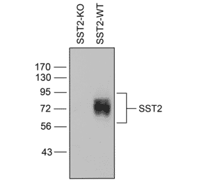 Western blot - Anti-SSTR2 Antibody (A334542) - Antibodies.com