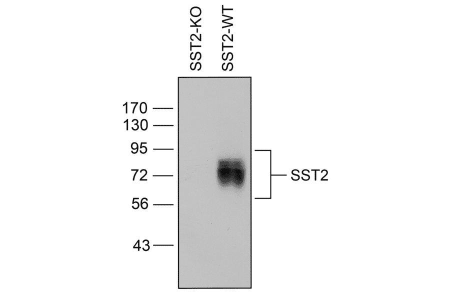 Western blot - Anti-SSTR2 Antibody (A334542) - Antibodies.com