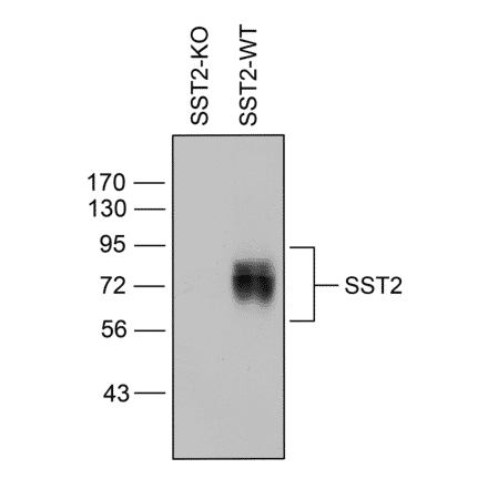 Western blot - Anti-SSTR2 Antibody (A334542) - Antibodies.com