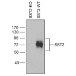 Western blot - Anti-SSTR2 Antibody (A334542) - Antibodies.com