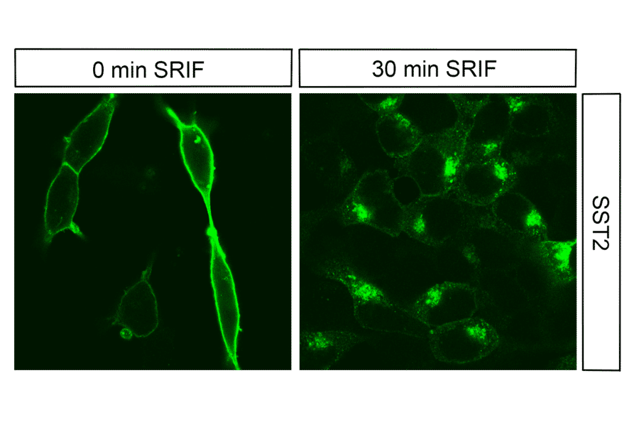 Immunohistochemistry - Anti-SSTR2 Antibody (A334542) - Antibodies.com