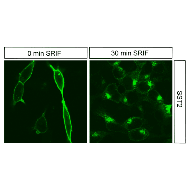 Immunohistochemistry - Anti-SSTR2 Antibody (A334542) - Antibodies.com