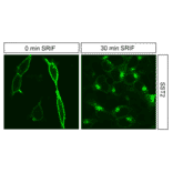 Immunohistochemistry - Anti-SSTR2 Antibody (A334542) - Antibodies.com