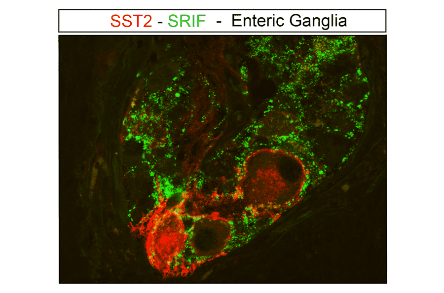Immunofluorescence - Anti-SSTR2 Antibody (A334542) - Antibodies.com