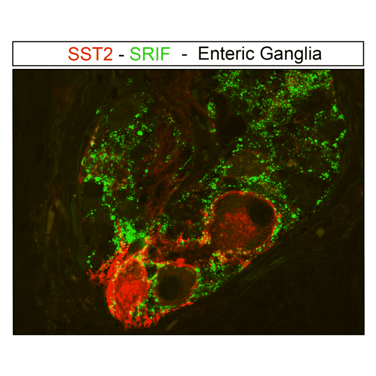 Immunofluorescence - Anti-SSTR2 Antibody (A334542) - Antibodies.com