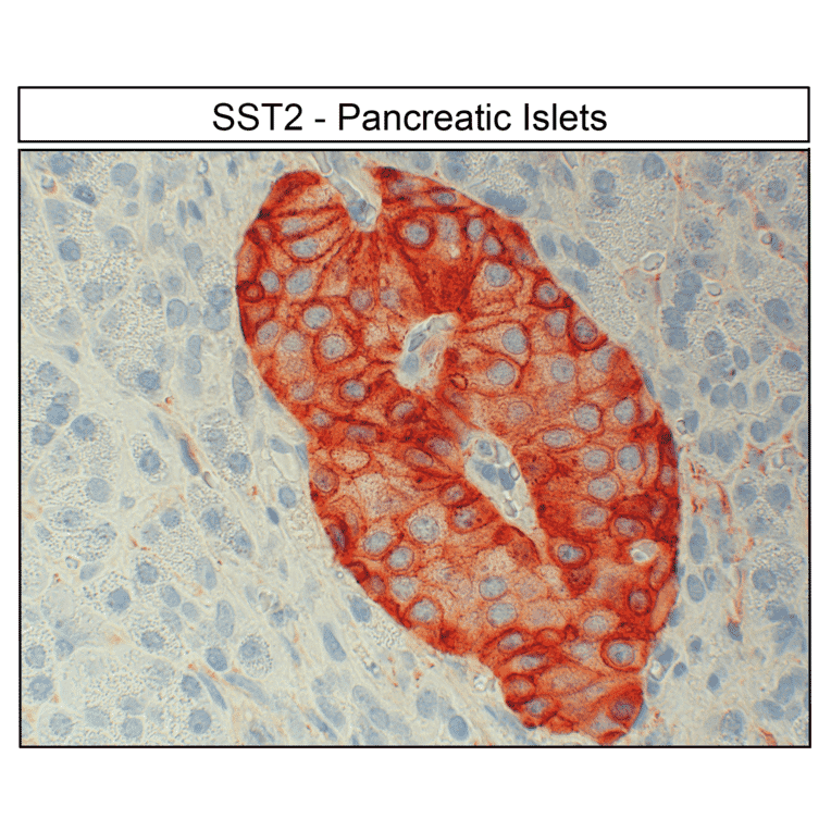 Immunohistochemistry - Anti-SSTR2 Antibody (A334542) - Antibodies.com