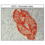 Immunohistochemistry - Anti-SSTR2 Antibody (A334542) - Antibodies.com