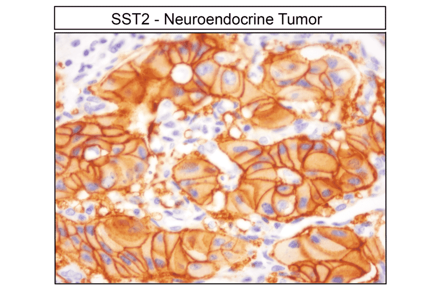 Immunohistochemistry - Anti-SSTR2 Antibody (A334542) - Antibodies.com