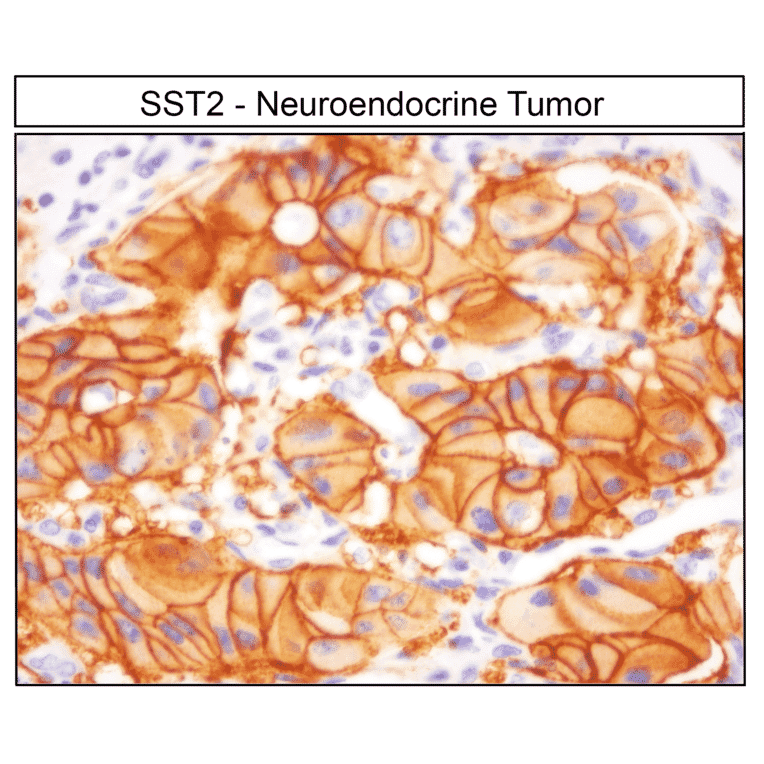 Immunohistochemistry - Anti-SSTR2 Antibody (A334542) - Antibodies.com