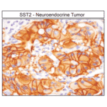 Immunohistochemistry - Anti-SSTR2 Antibody (A334542) - Antibodies.com
