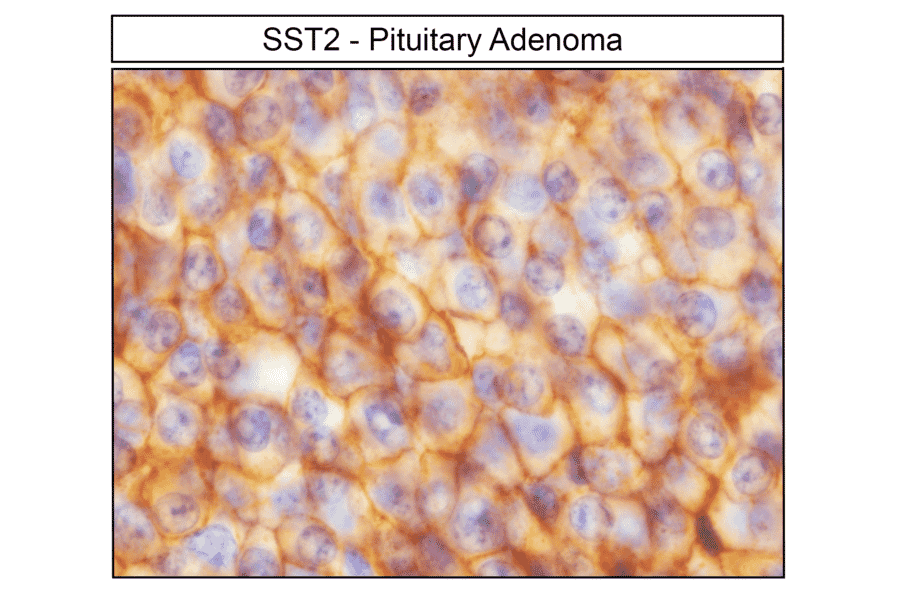 Immunohistochemistry - Anti-SSTR2 Antibody (A334542) - Antibodies.com