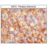 Immunohistochemistry - Anti-SSTR2 Antibody (A334542) - Antibodies.com