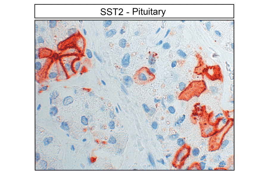 Immunohistochemistry - Anti-SSTR2 Antibody (A334542) - Antibodies.com