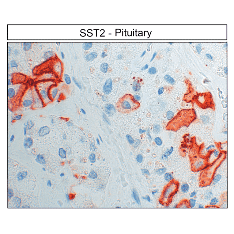 Immunohistochemistry - Anti-SSTR2 Antibody (A334542) - Antibodies.com