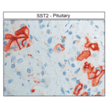 Immunohistochemistry - Anti-SSTR2 Antibody (A334542) - Antibodies.com