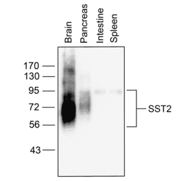 Western blot - Anti-SSTR2 Antibody (A334543) - Antibodies.com