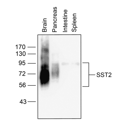 Western blot - Anti-SSTR2 Antibody (A334543) - Antibodies.com