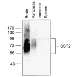 Western blot - Anti-SSTR2 Antibody (A334543) - Antibodies.com