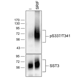 Western blot - Anti-SSTR3 (phospho Ser337 + Thr341) Antibody (A334544) - Antibodies.com