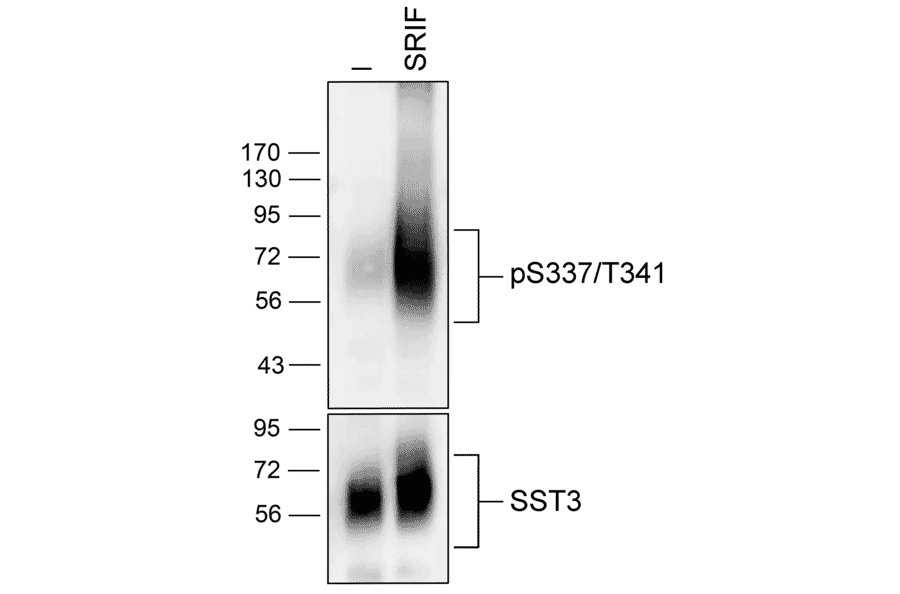 Western blot - Anti-SSTR3 (phospho Ser337 + Thr341) Antibody (A334544) - Antibodies.com