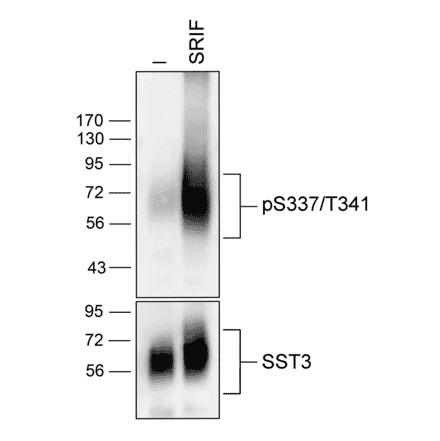 Western blot - Anti-SSTR3 (phospho Ser337 + Thr341) Antibody (A334544) - Antibodies.com