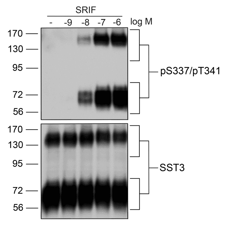 Western blot - Anti-SSTR3 (phospho Ser337 + Thr341) Antibody (A334544) - Antibodies.com