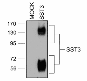 Western blot - Anti-SSTR3 Antibody (A334545) - Antibodies.com