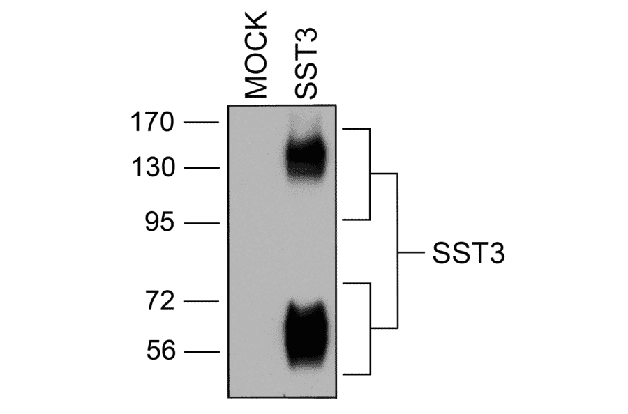 Western blot - Anti-SSTR3 Antibody (A334545) - Antibodies.com