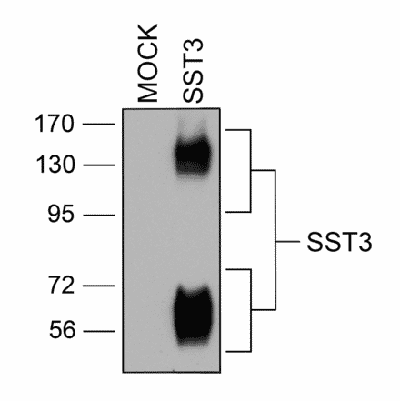 Western blot - Anti-SSTR3 Antibody (A334545) - Antibodies.com