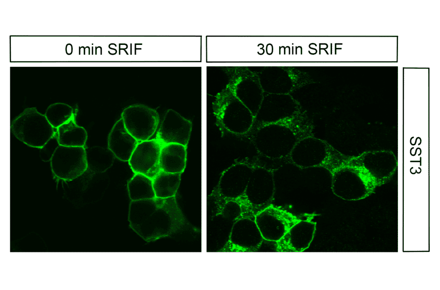Immunohistochemistry - Anti-SSTR3 Antibody (A334545) - Antibodies.com