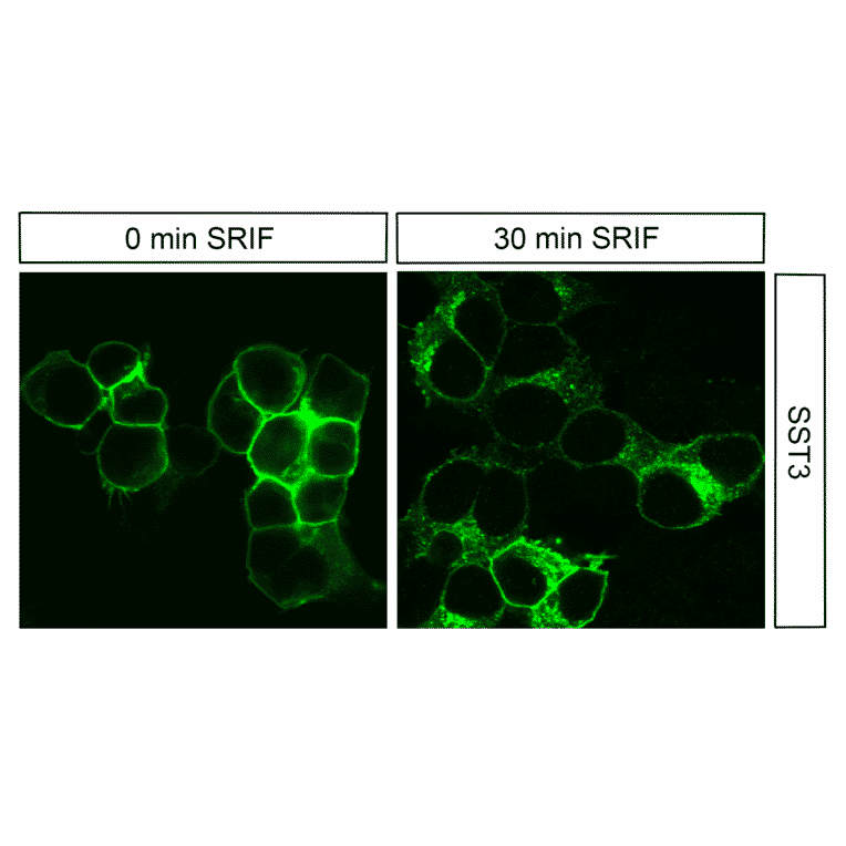 Immunohistochemistry - Anti-SSTR3 Antibody (A334545) - Antibodies.com