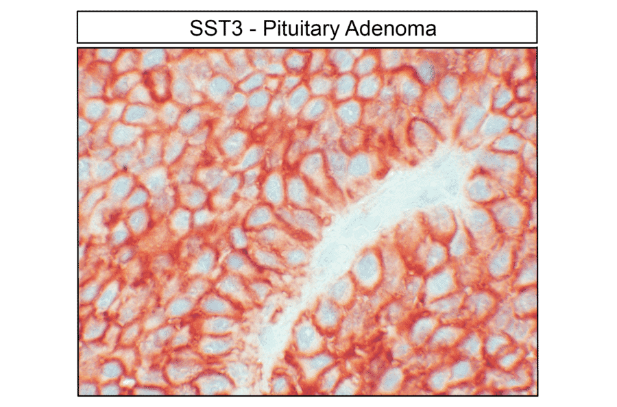 Immunohistochemistry - Anti-SSTR3 Antibody (A334545) - Antibodies.com