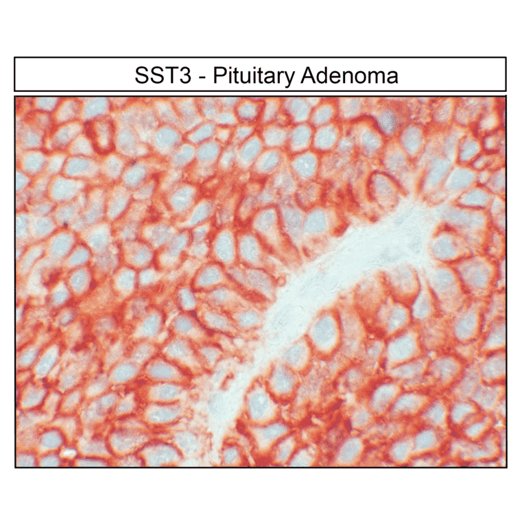 Immunohistochemistry - Anti-SSTR3 Antibody (A334545) - Antibodies.com