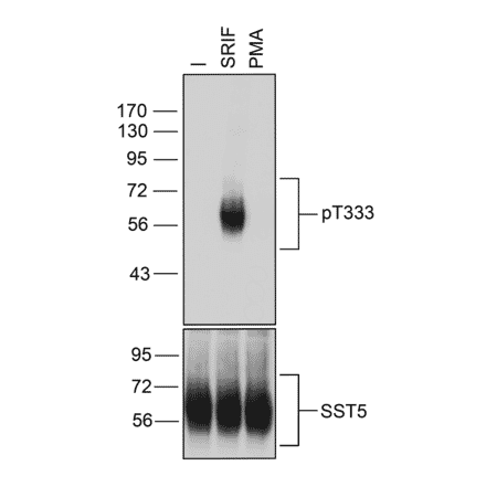 Western blot - Anti-SSTR5 (phospho Thr333) Antibody (A334546) - Antibodies.com
