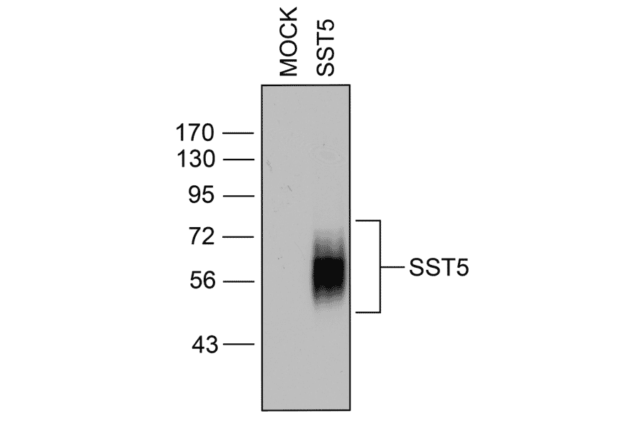 Western blot - Anti-SSTR5 Antibody (A334547) - Antibodies.com